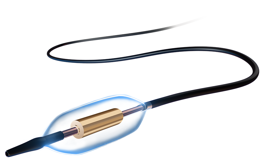 Recor Paradise uRDN System Catheter