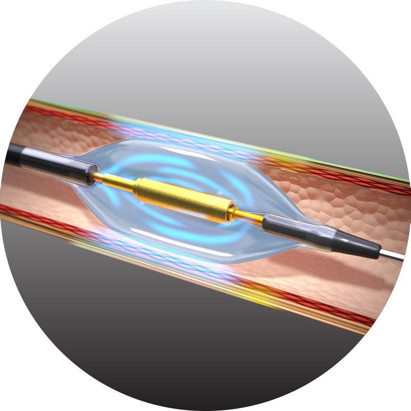 Paradise Ultrasound Renal Denervation HydroCooling System