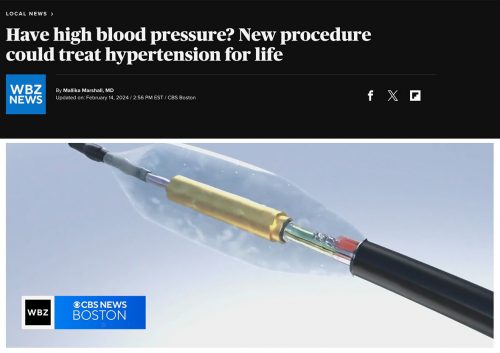 cbsnews-boston-news-blood-pressure-hypertension-procedure-2